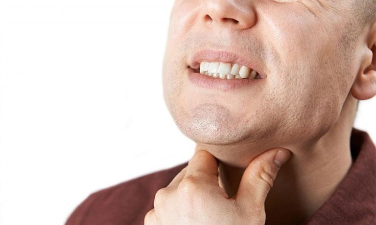 Người bệnh có thể bị đau rát họng và sưng hạch ở cổ