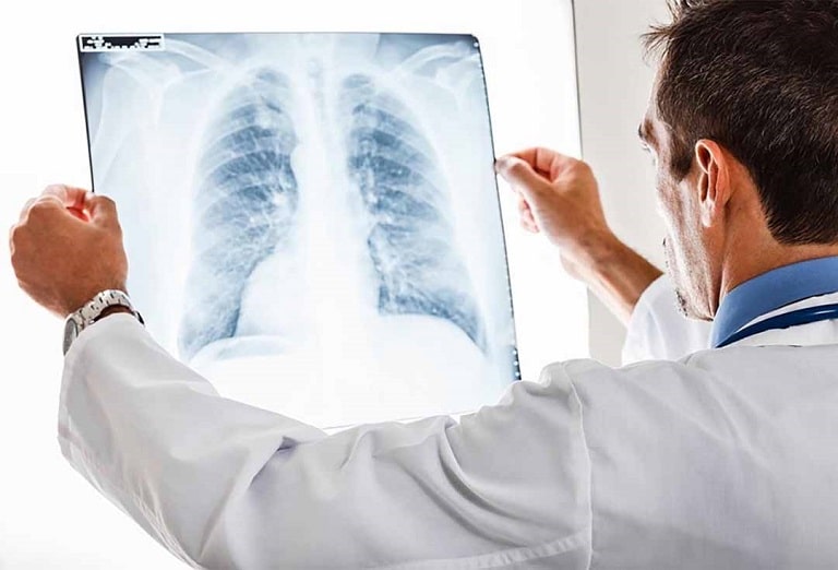 Tình trạng này có thể cảnh báo bệnh lý về phổi rất nguy hiểm cho người bệnh