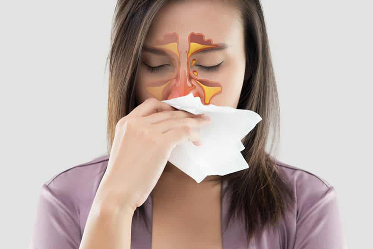 Nghẹt mũi là một trong những dấu hiệu thường gặp của bệnh viêm xoang