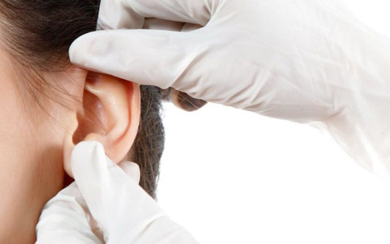 Điều trị viêm tai giữa cấp bằng ngoại khoa