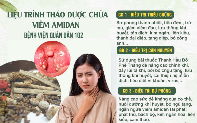 Liệu trình thảo dược chữa viêm amidan Quân dân 102