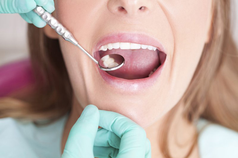 Bệnh răng miệng biến chứng thành viêm xoang hàm 2 bên