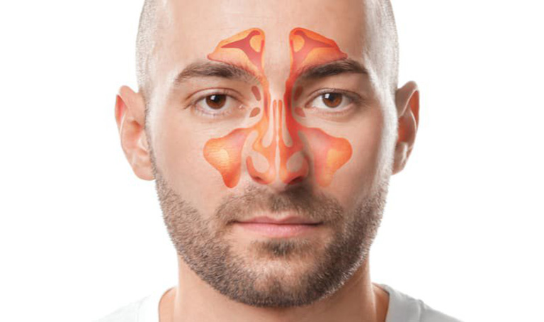 Xoang hàm có cấu tạo gồm các hốc xoang ở quanh mắt hoặc hai bên má