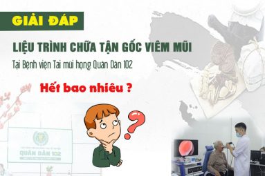 Chi phí điều trị viêm mũi tại Bệnh viện Tai mũi họng Quân Dân 102 bao nhiêu?