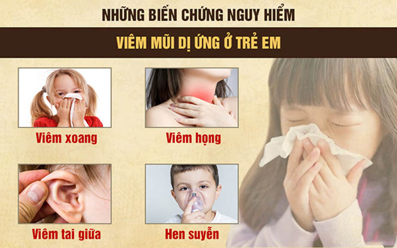 Viêm mũi dị ứng ở trẻ em nếu không được điều trị tốt sẽ gây ra nhiều biến chứng nguy hiểm