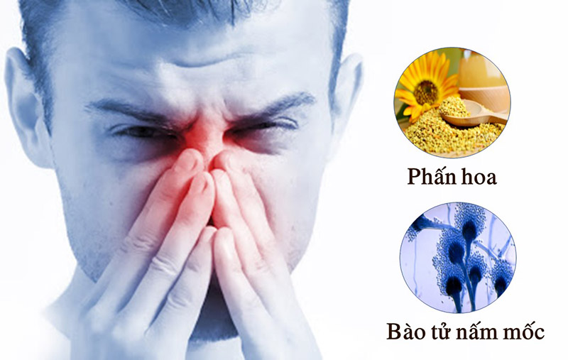 Nguyên nhân gây viêm mũi dị ứng theo mùa