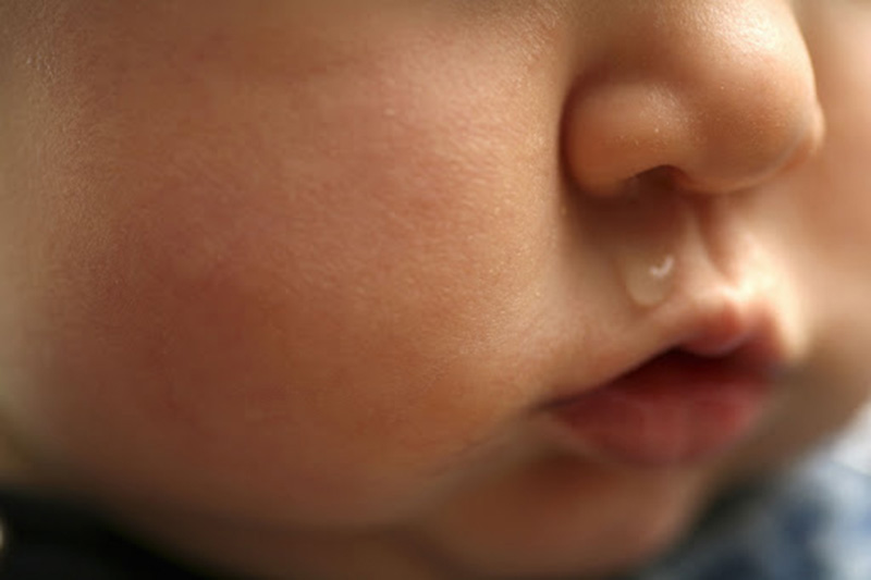 Khi bị viêm mũi xuất tiết, trẻ thường xuyên chảy nước mũi trong, sau đó mới chuyển sang đục hoặc vàng